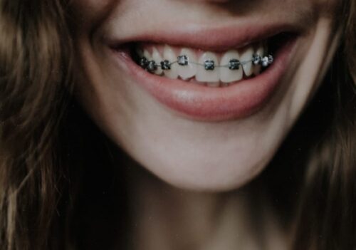 brackets